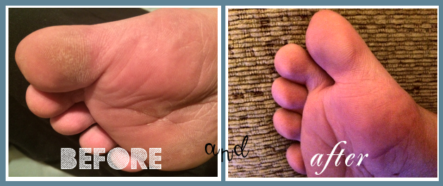 Amope Pedi Perfect Before and After