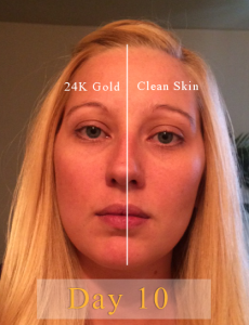 24K Gold Serum Results Day 10