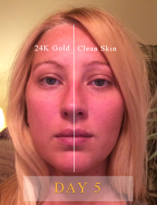 24K Gold Serum Results Day 5